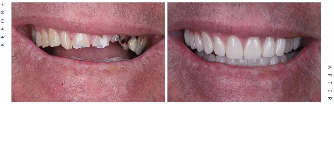 Brett-After-Before-1